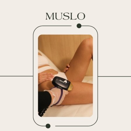 Depilación láser de muslos con tecnología tridiodo Soprano ICE Platinum en EVO Beauty Clinics Polanco