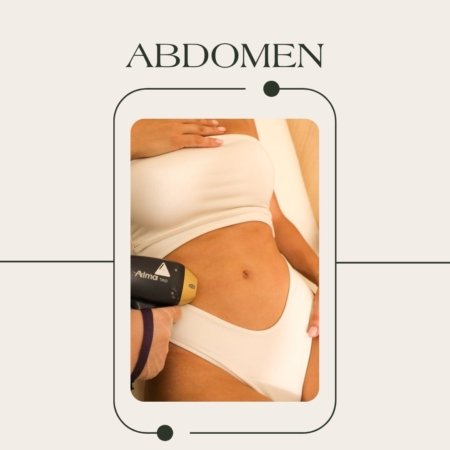 Depilación láser de abdomen con tecnología tridiodo Soprano ICE Platinum en EVO Beauty Clinics Polanco