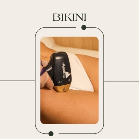 Depilación láser bikini con tecnología tridiodo Soprano ICE Platinum en EVO Beauty Clinics Polanco