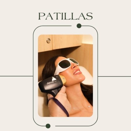 Depilación láser de patillas con tecnología tridiodo Soprano ICE Platinum en EVO Beauty Clinics Polanco